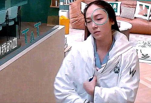 明星遭遇蚊子咬